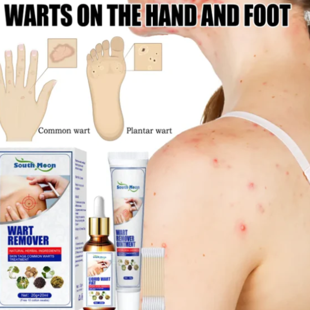 COMBO: 1 CREMA + 1 SERUM Eliminador de Verrugas, forma segura y sin dolor! | resultados en semanas – 50% de DESCUENTO