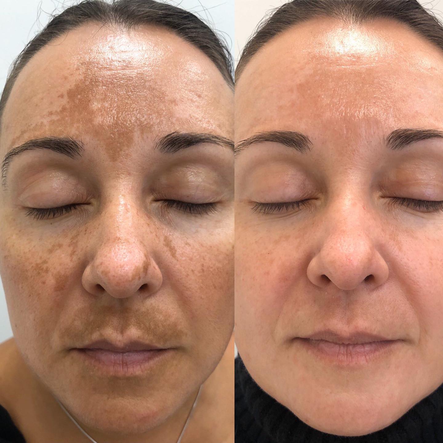 💧 SERUM ROSA MOSQUETA AYUDA A ACL@RAR CODOS, AXILAS Y ROSTRO ✨