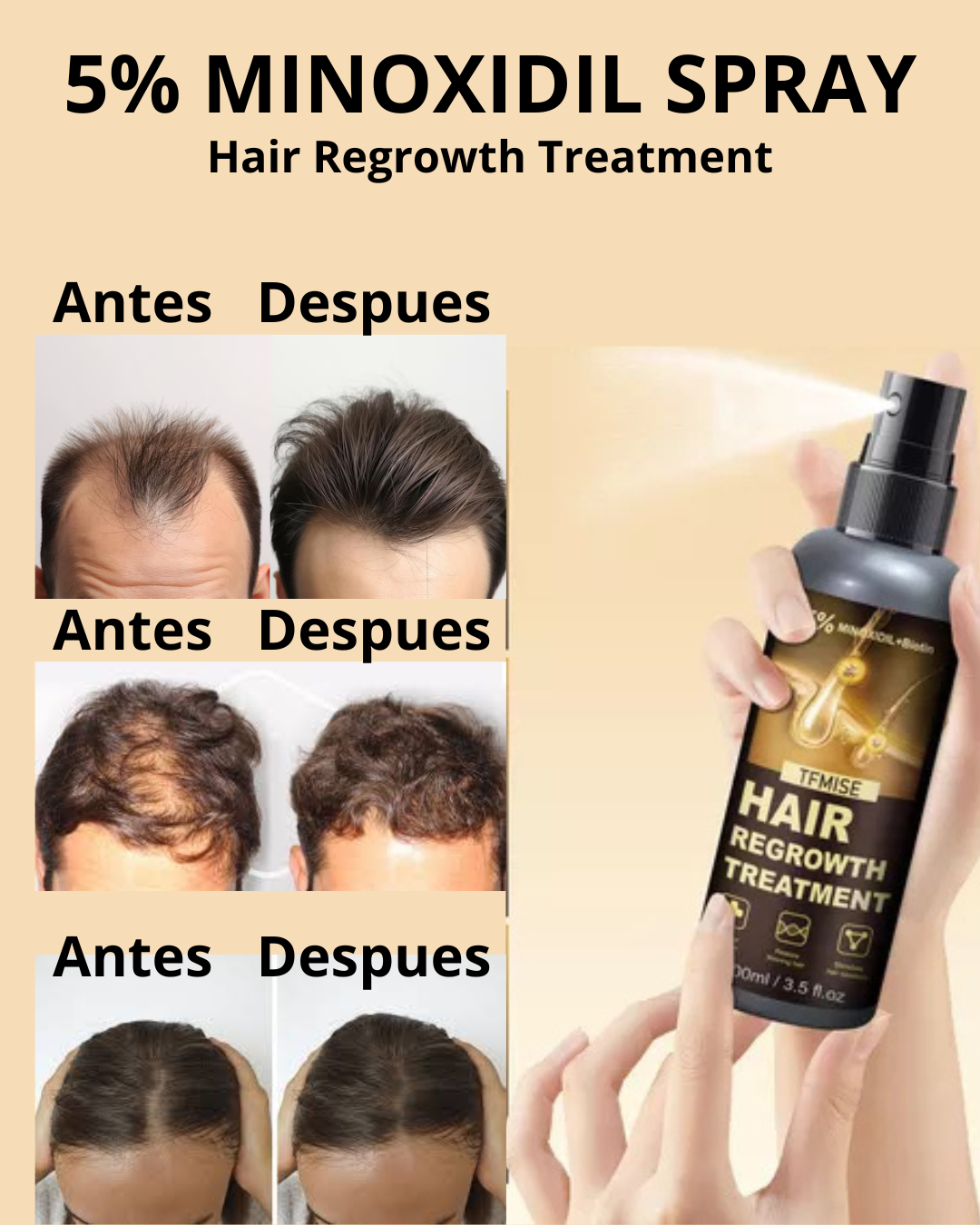 Tratamiento efectivo para el crecimiento del cabello y la barba. CON MINOXIDIL 5% 🎁 50% DSCNTO