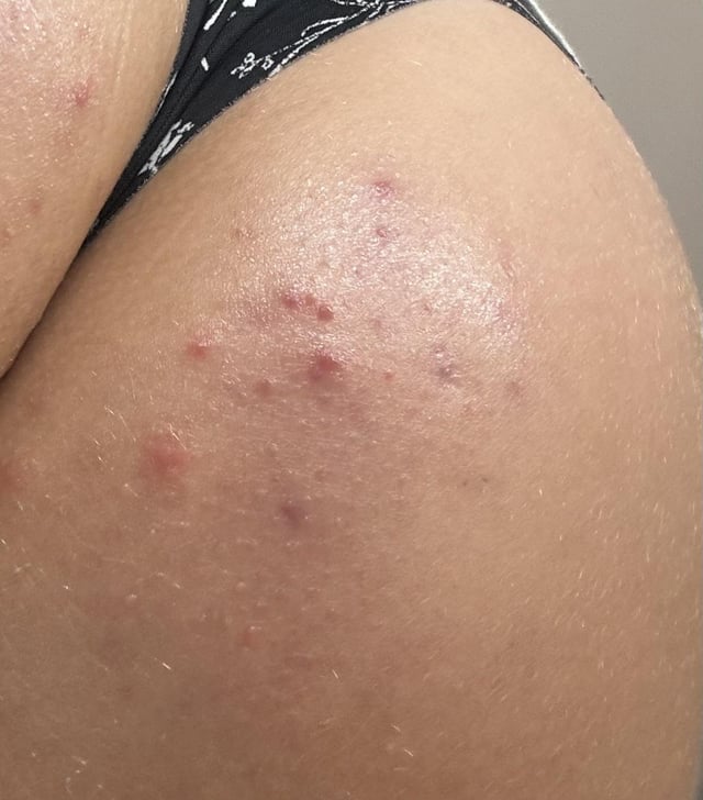Gel Exfoliante con Sal Rosa del Himalaya – Tu piel más limpia y suave desde la primera aplicación ¡HOY con el 50% de descuento!