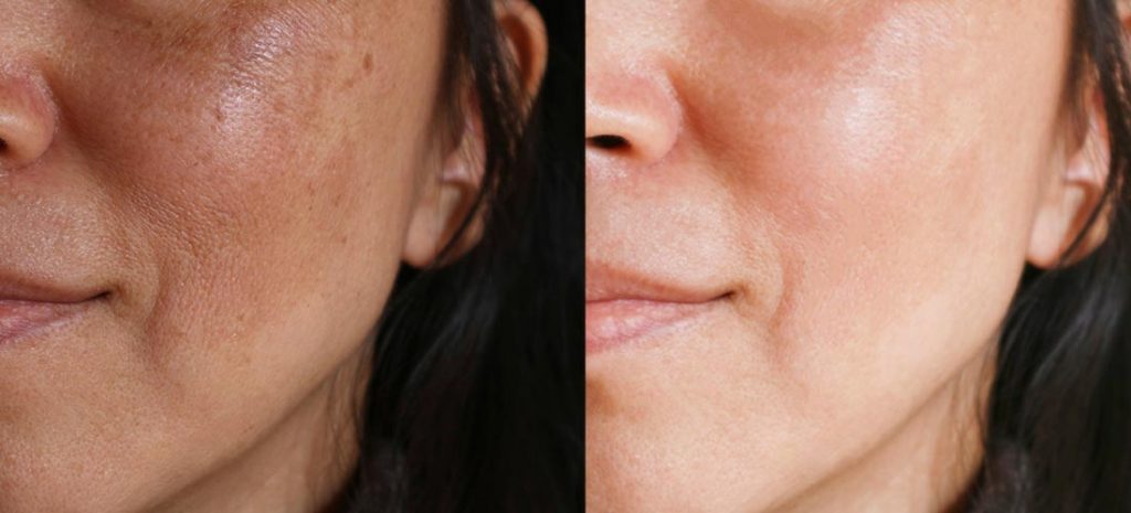 💧 SERUM ROSA MOSQUETA AYUDA A ACL@RAR CODOS, AXILAS Y ROSTRO ✨