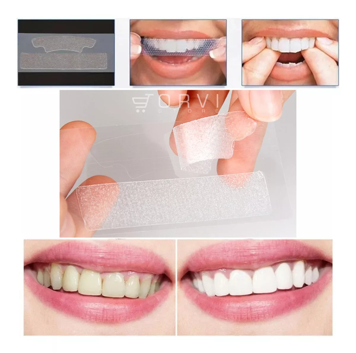 PAGA 7 LLEVA 14 PAQUETES DE ACLARAMIENTO DENTAL DESDE CASA! DIENTES MÁS BLANCOS 🤩