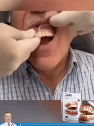 Dentadura Postiza de resina de acrílico dental ¡Recupera tu sonrisa sin dolor ni odontólogos! | – con el 50% de descuento solo por hoy