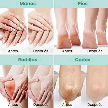 Crema Reparadora Urea al 40% – Hidratación Profunda para Manos y Pies ¡Con el 50% de descuento!