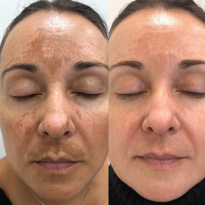 💧 SERUM ROSA MOSQUETA AYUDA A ACL@RAR CODOS, AXILAS Y ROSTRO ✨
