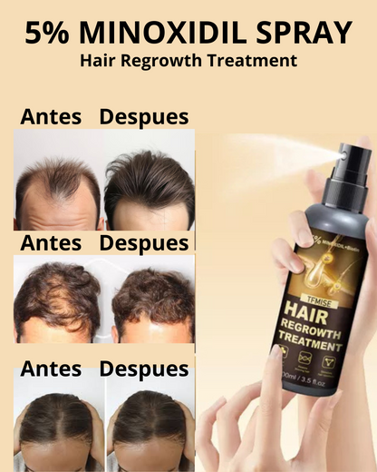 Tratamiento efectivo para el crecimiento del cabello y la barba. CON MINOXIDIL 5% 🎁 50% DSCNTO