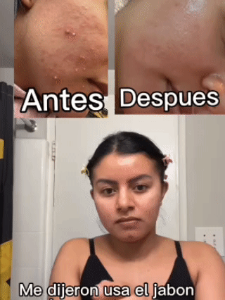 PAGA 1 Y LLEVA 2 Jabones Aclarador Multizona de Ácido Kójico – Aclara Manchas Visibles + 50% Dto Hoy