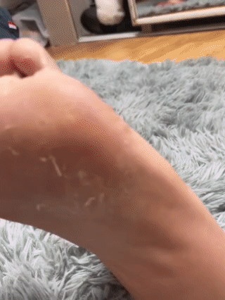 Crema Reparadora Urea al 40% – Hidratación Profunda para Manos y Pies ¡Con el 50% de descuento!