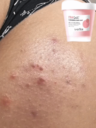 Gel Exfoliante con Sal Rosa del Himalaya – Tu piel más limpia y suave desde la primera aplicación ¡HOY con el 50% de descuento!